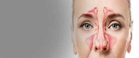 sinusitis-2